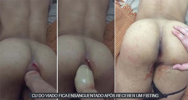 michê faz fisting e deixa o cu do viado ensanguentado sexo amador gay