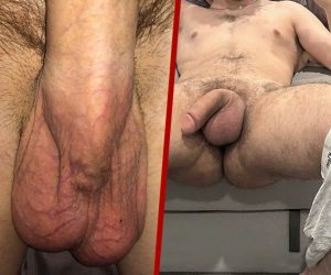 27 Big escrotal nude